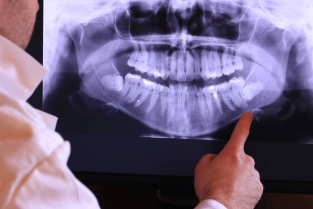 Best Emergency Treatment for Jaw Pain or Injury in Doylestown, OH