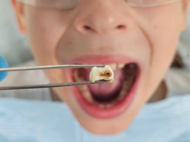 Best Emergency Pediatric Dental Care in Doylestown, OH